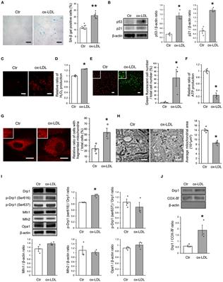 Association of Lectin-Like Oxidized Low-Density Lipoprotein Receptor-1 With Angiotensin II Type 1 Receptor Impacts Mitochondrial Quality Control, Offering Promise for the Treatment of Vascular Senescence